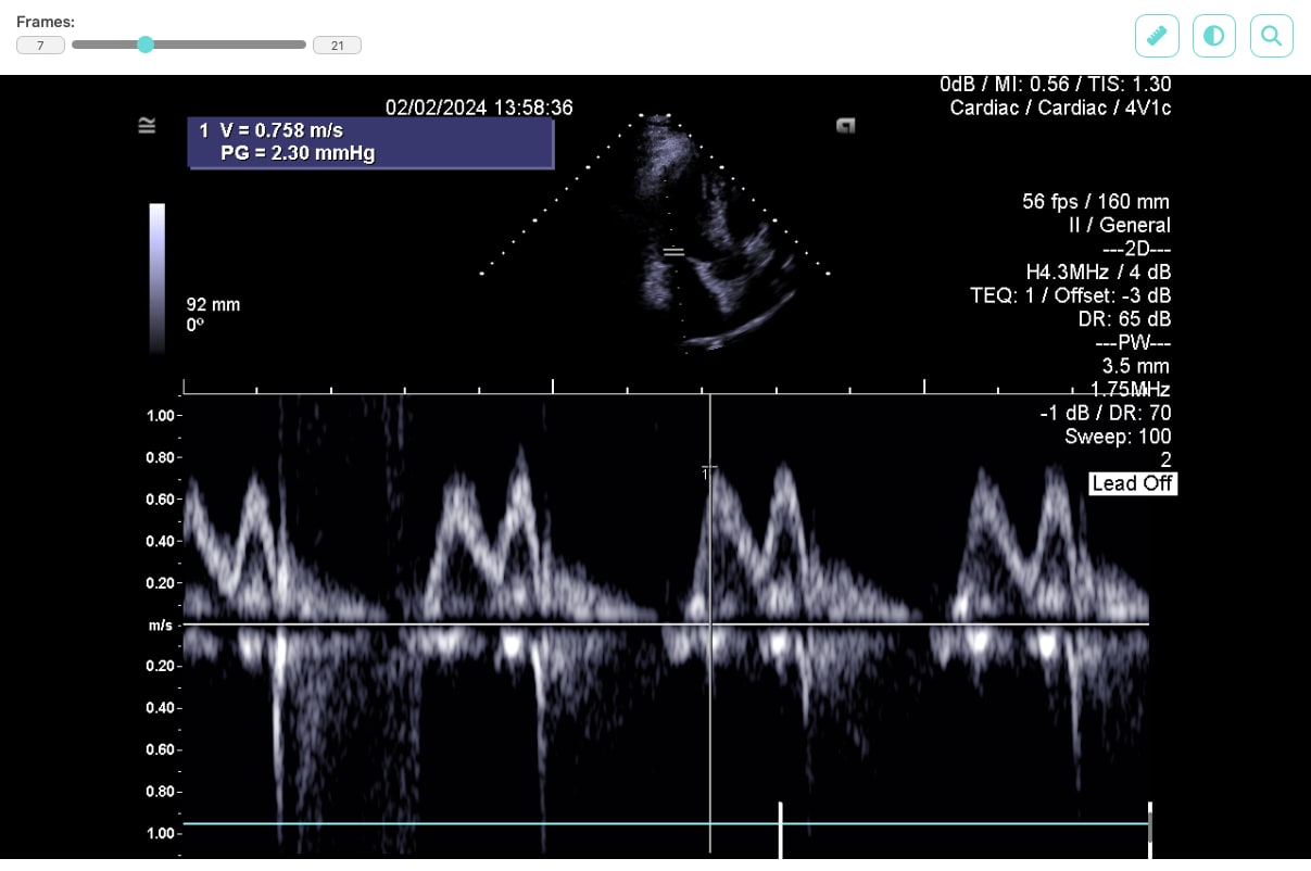 JavaScript DICOM file viewer integrated into a web application